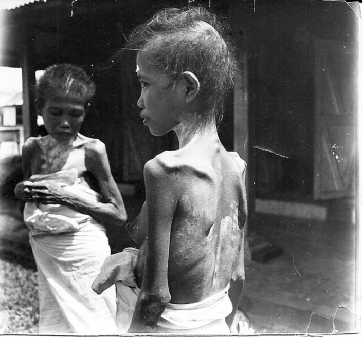 This photo clearly shows the devastating impact of war.